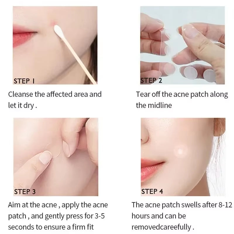 72 Pcs Acne Pimple Patch Invisible Waterproof Absorb Pus Acne Pimple Remover Tool Acne Cleaner Spot Concealer Care Product