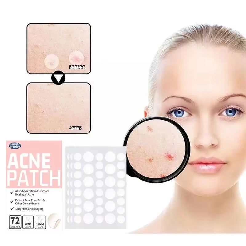 72 Pcs Acne Pimple Patch Invisible Waterproof Absorb Pus Acne Pimple Remover Tool Acne Cleaner Spot Concealer Care Product